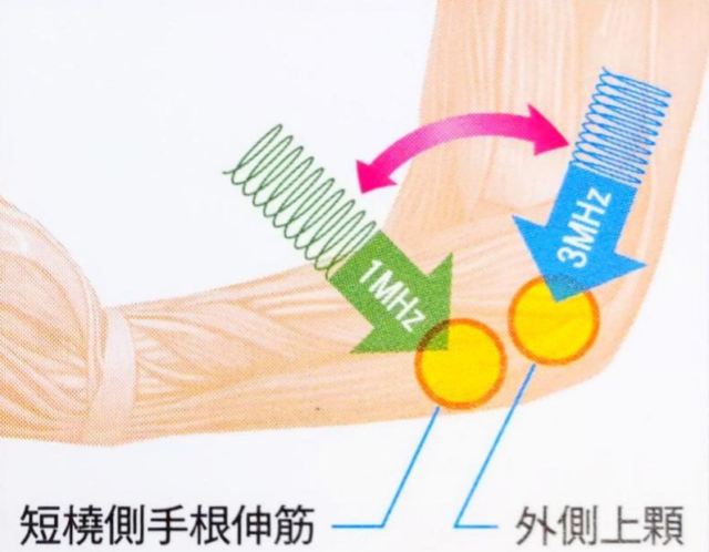 ◆周波数自動切替Swichモード