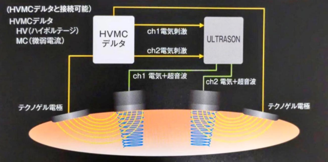 ◆HVMCデルタとのコンビネーション治療