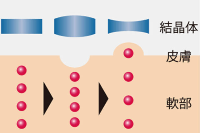 1秒間に数百万回のミクロマッサージ効果 / ULTRASOUND