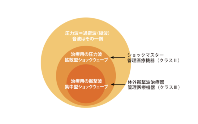 体外衝撃波治療器とショックマスターの違い（2）